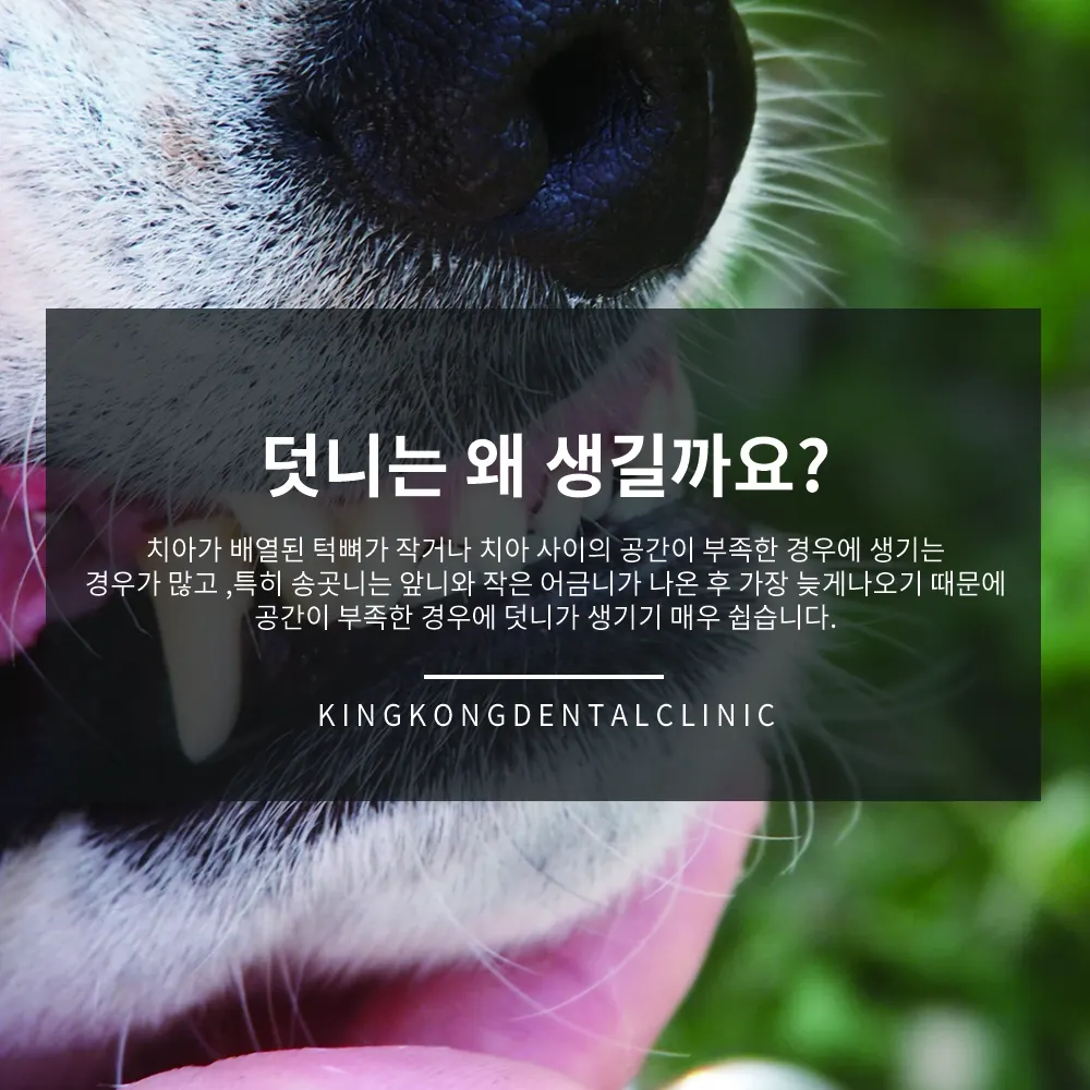 덧니는 왜 생길까요? — 공지 이미지