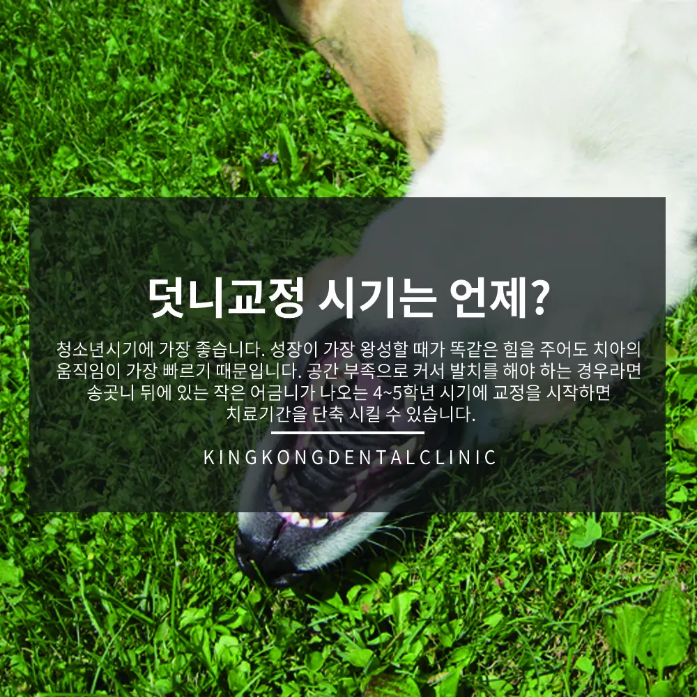 덧니는 왜 생길까요? — 공지 이미지