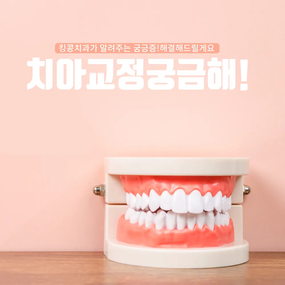 치아교정 이것이 궁금해!!!! — 공지 이미지