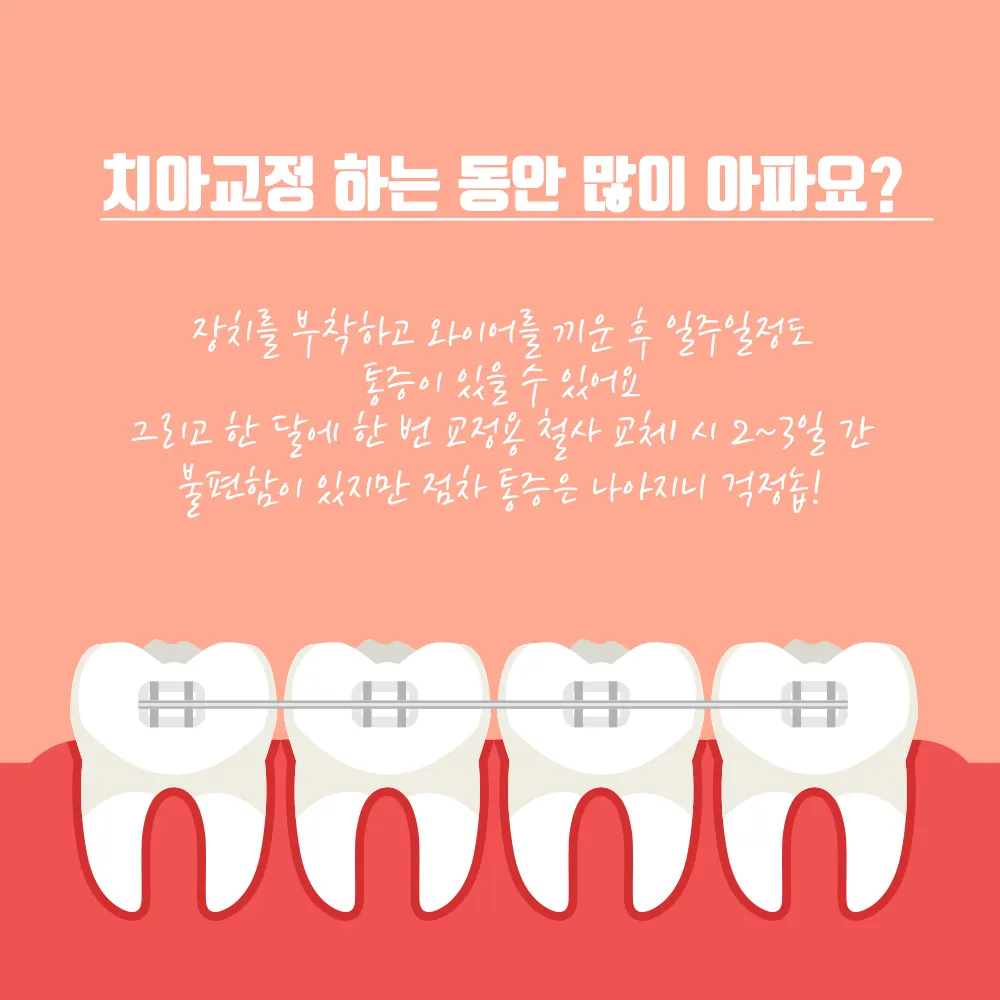 치아교정 이것이 궁금해!!!! — 공지 이미지
