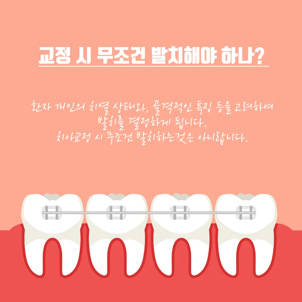 치아교정 이것이 궁금해!!!! — 공지 이미지