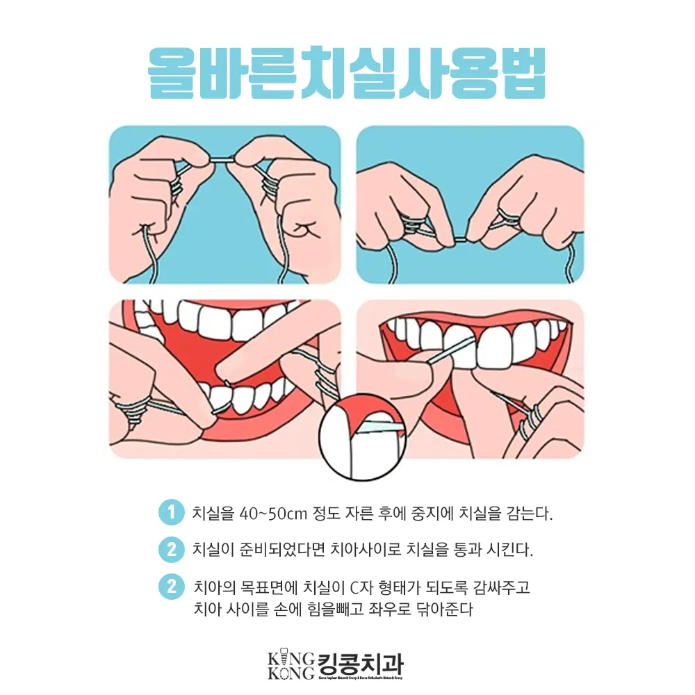 올바른 치실사용법^^* — 공지 이미지