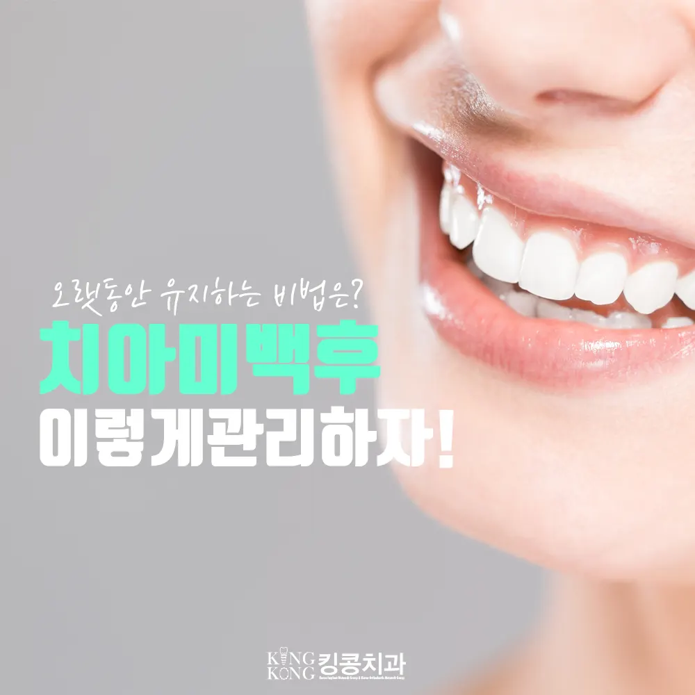 치아미백 후 이렇게 관리하자 ^^* — 공지 이미지